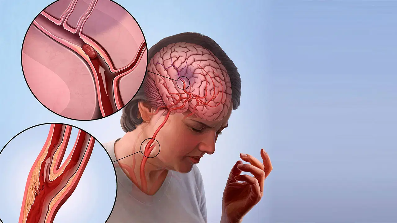 Türkiye’de bu sebepten dolayı her yıl 45 bin insan ölüyor!