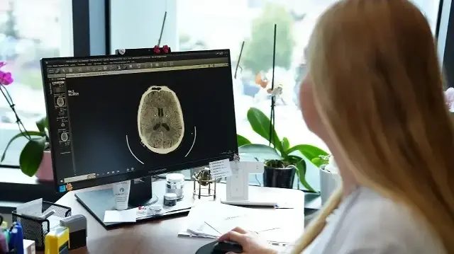 kume bas agrisi nedir belirtileri nelerdir uzmanindan onemli uyarilar 4mwQSZg3.webp